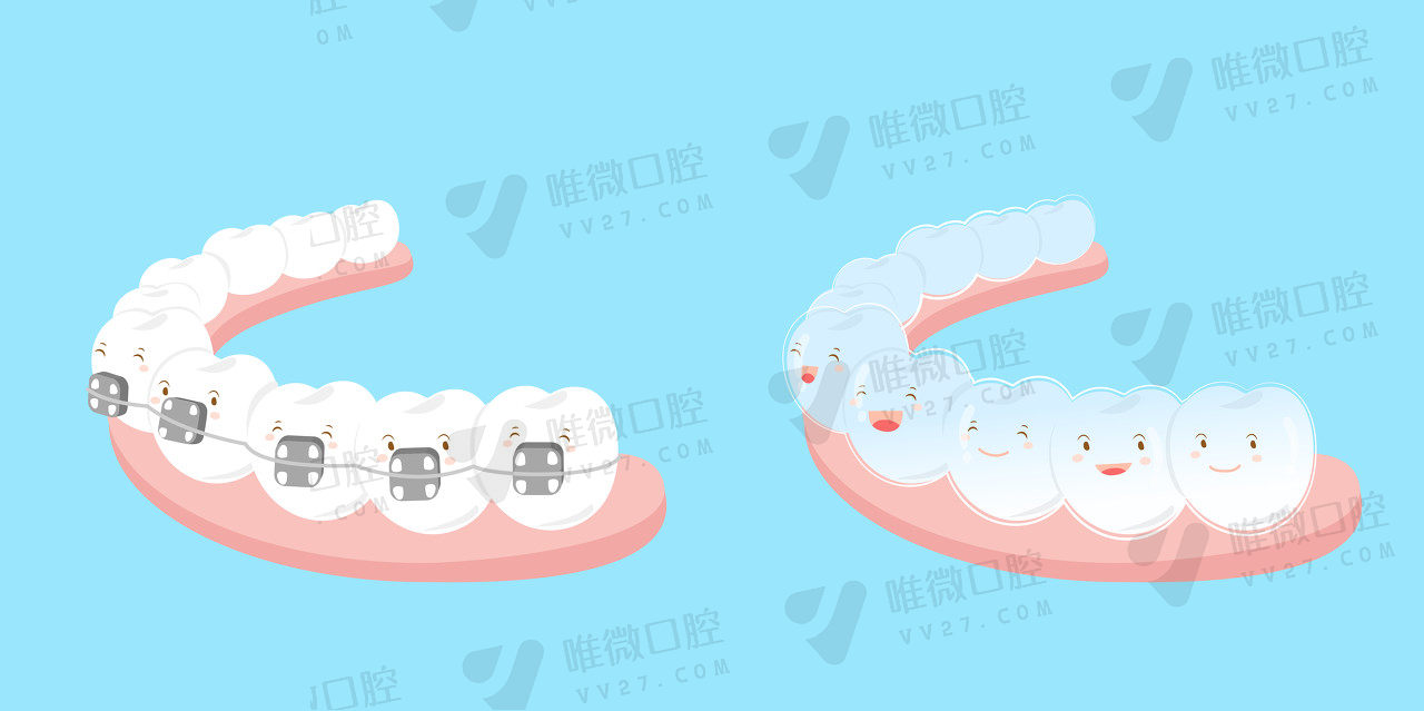 龅牙矫正的术后注意事项